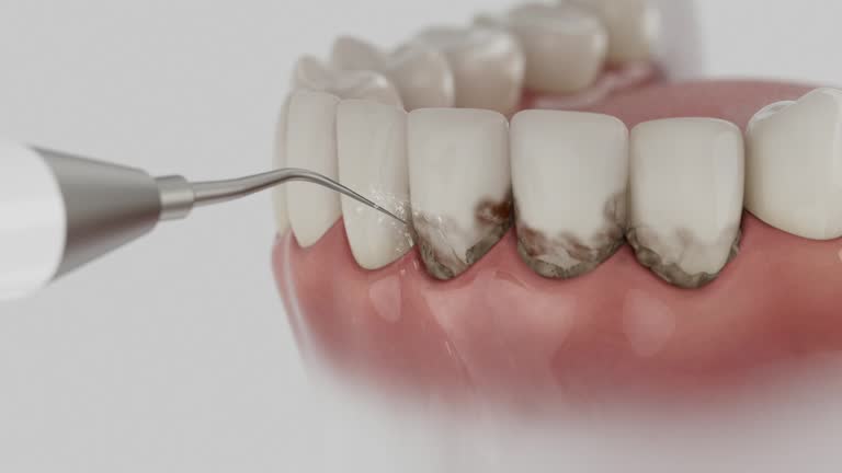 Reliable Dental Implants contractor in Unalaska, AK by Smile Center Dentistry